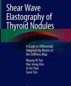 Shear Wave Elastography of Thyroid Nodules: A Guide to Differential Diagnosis by Means of the Stiffness Map (PDF)