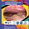 Lumbar Spine (PDF)