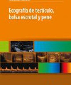 Ecografía de Testículo, Bolsa Escrotal y Pene (High Quality Image PDF)