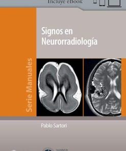 SIGNOS EN NEURORRADIOLOGIA (High Quality Image PDF)