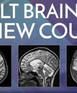 Adult Brain MRI Review Course – Online (CME VIDEOS)