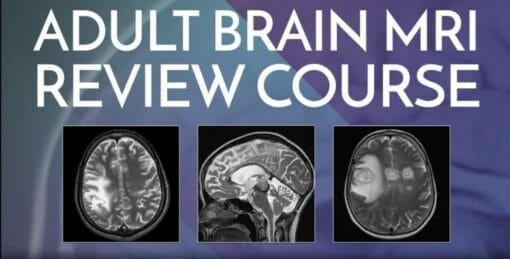 Adult Brain MRI Review Course – Online (CME VIDEOS)