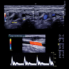 Clinical Approach to Vascular Ultrasound and RPVI Prep Course 2021 (CME VIDEOS)