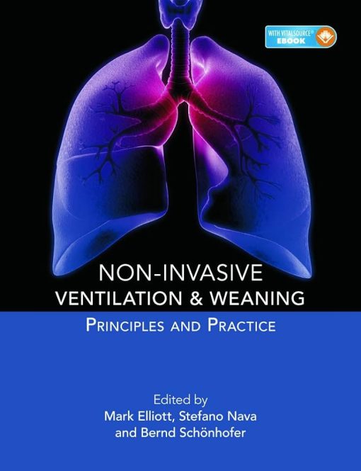 Non-invasive Ventilation and Weaning: Principles and Practice