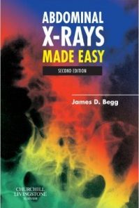 Abdominal X-Rays Made Easy, 2nd Edition