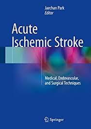 Acute Ischemic Stroke: Medical, Endovascular, and Surgical Techniques 1st e