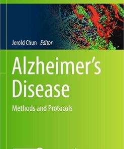 Alzheimer’s Disease: Methods and Protocols (Methods in Molecular Biology, 2561) 1st ed. 2023 Edition PDF