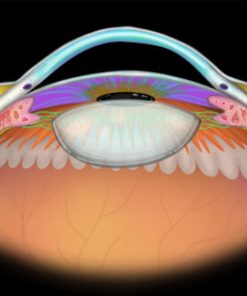 MRIOnline Imaging Mastery Series Orbit 2019 (CME VIDEOS)