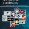 Aneurismas cerebrales: Tratamiento microquirúrgico 2022 Original PDF