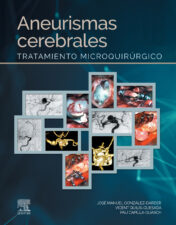 Aneurismas cerebrales: Tratamiento microquirúrgico 2022 Original PDF