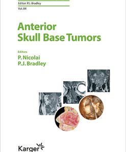 Anterior Skull Base Tumors (Advances in Oto-Rhino-Laryngology, Vol. 84) (PDF)
