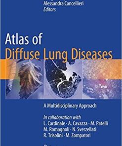 Atlas of Diffuse Lung Diseases: A Multidisciplinary Approach 1st ed. 2017 Edition