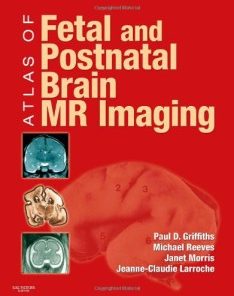 Atlas of Fetal and Postnatal Brain MR Imaging