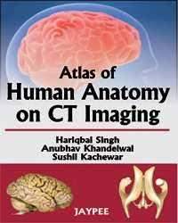 Atlas of Human Anatomy on CT Imaging