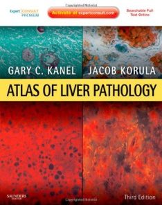 Atlas of Liver Pathology: Expert Consult – Online and Print, 3rd