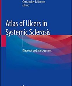 Atlas of Ulcers in Systemic Sclerosis: Diagnosis and Management