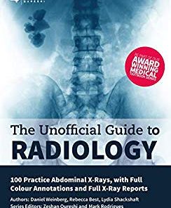 Unofficial Guide to Radiology: 100 Practice Abdominal X-Rays (EPUB)