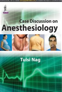 Case Discussion on Anesthesiology