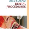 Basic Guide to Dental Procedures