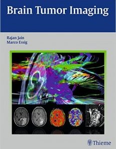 Brain Tumor Imaging