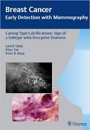 Breast Cancer: Early Detection with Mammography: Casting Type Calcifications: Sign of a Subtype with Deceptive Features