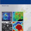 Breast Elastography Kindle Edition