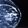 UCSF Breast Imaging and Digital Mammography 2014 (CME Videos)