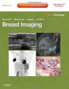 Breast Imaging: Expert Radiology series