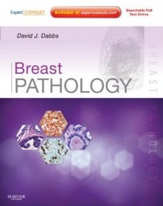 Breast Pathology – Expert Consult