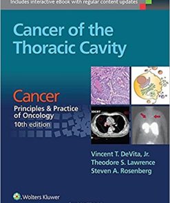 Cancer of the Thoracic Cavity: Cancer: Principles & Practice of Oncology, 10th edition (EPUB)