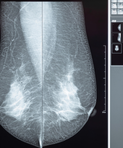 Comprehensive Review of Breast Imaging 2022 (CME VIDEOS)