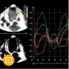 Echocardiography – A Comprehensive Review 2022 (CME VIDEOS)