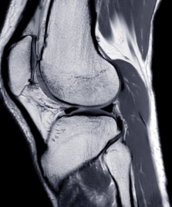 UCSF Neuro and Musculoskeletal Imaging 2022 (CME VIDEOS)