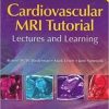 Cardiovascular MRI Tutorial: Lectures and Learning