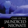 Care of the Jaundiced Neonate