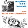 Cesarean Delivery A Comprehensive Illustrated Practical Guide