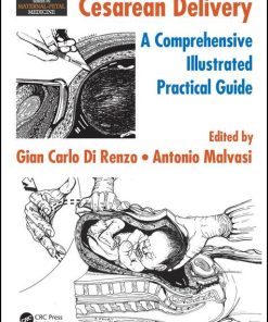 Cesarean Delivery A Comprehensive Illustrated Practical Guide