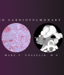 Chest and Cardiopulmonary Imaging – Marc V. Gosselin, M.D (Videos + PDF)