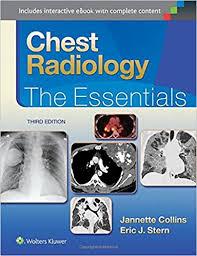 Chest Radiology: The Essentials (Essentials series)