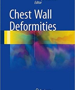 Chest Wall Deformities 1st ed. 2017 Edition