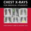 Chest X-rays for Medical Students 1st Edition