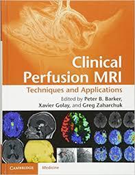 Clinical Perfusion MRI: Techniques and Applications