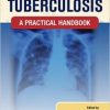 Clinical Tuberculosis: A Practical Handbook (PDF)