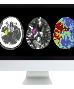 Code Stroke: What Every Radiologist Should Know 2022