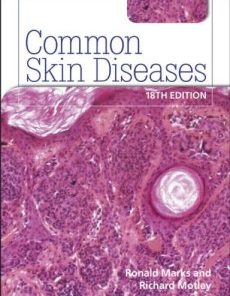 Common Skin Diseases 18th