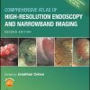 Comprehensive Atlas of High-Resolution Endoscopy and Narrowband Imaging 2nd