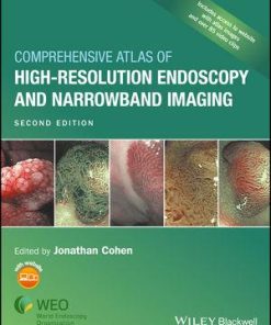 Comprehensive Atlas of High-Resolution Endoscopy and Narrowband Imaging 2nd