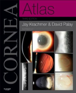 Cornea Atlas: Expert Consult – Online and Print, 3rd