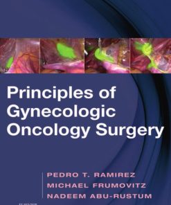 Principles of Gynecologic Oncology Surgery (PDF)