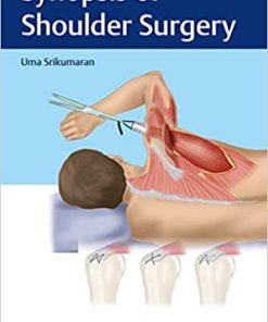 Synopsis of Shoulder Surgery (PDF)
